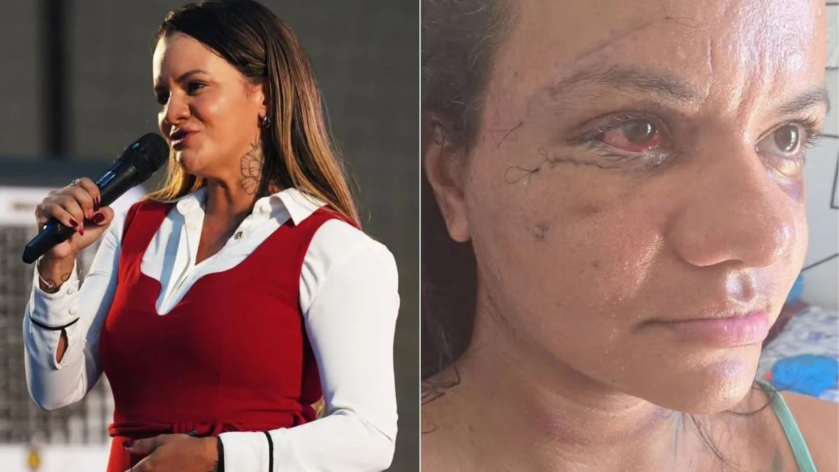 Um ano após agressão, mulher espancada com 61 socos é candidata a deputada estadual no RN: ‘Vi a necessidade’