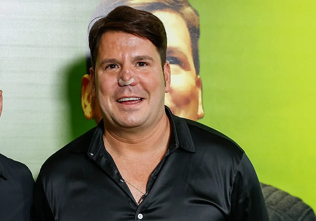 Lucas, de Andy y Lucas, sobre lo que se ha gastado en su nueva nariz: «Con 6.000 euros no te da»