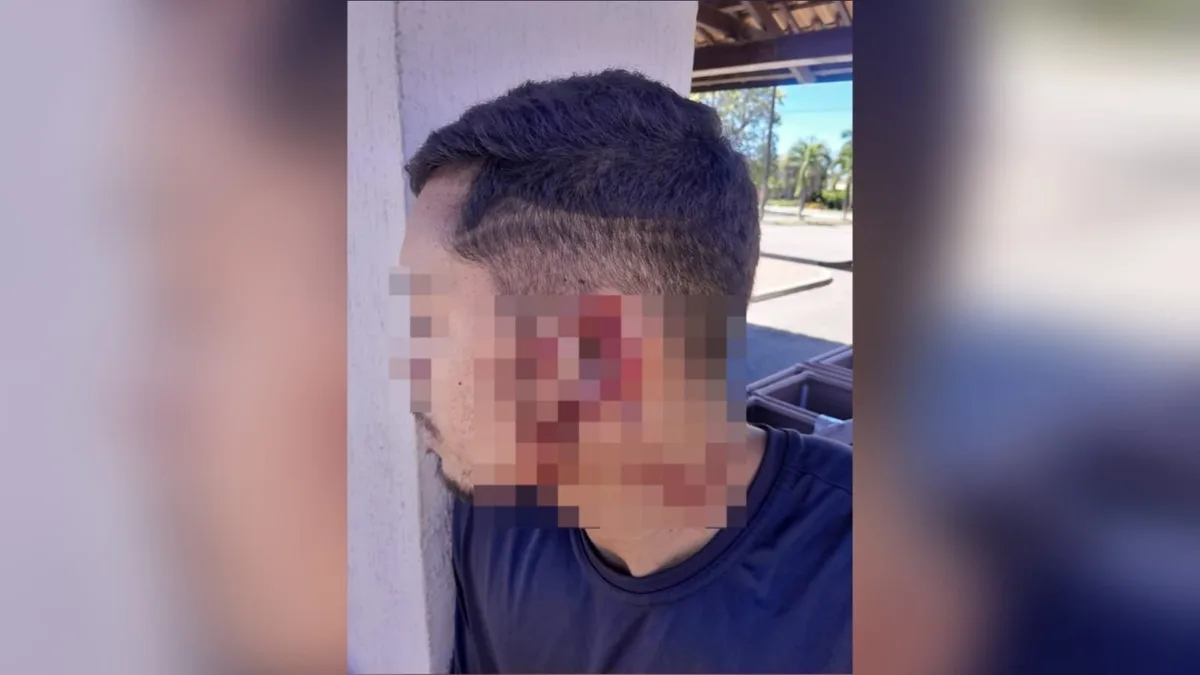 Homem morde e arranca pedaço de orelha de entregador em discussão iniciada por política