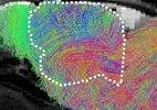 Cientistas implantam tecido cerebral humano em ratos