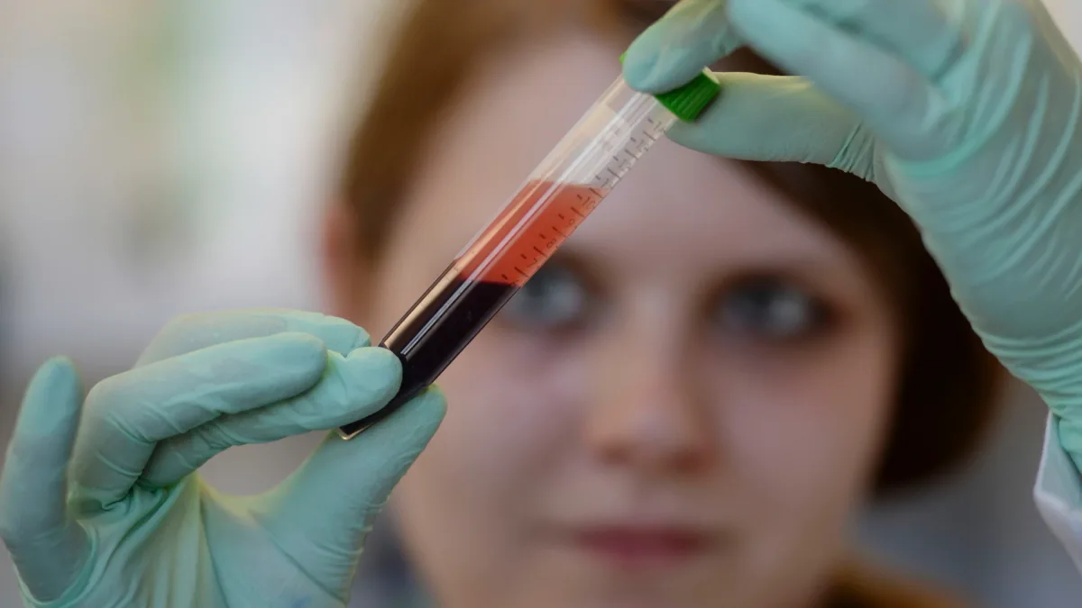 Pränataldiagnostik: Auch über Abtreibungen muss gesprochen werden