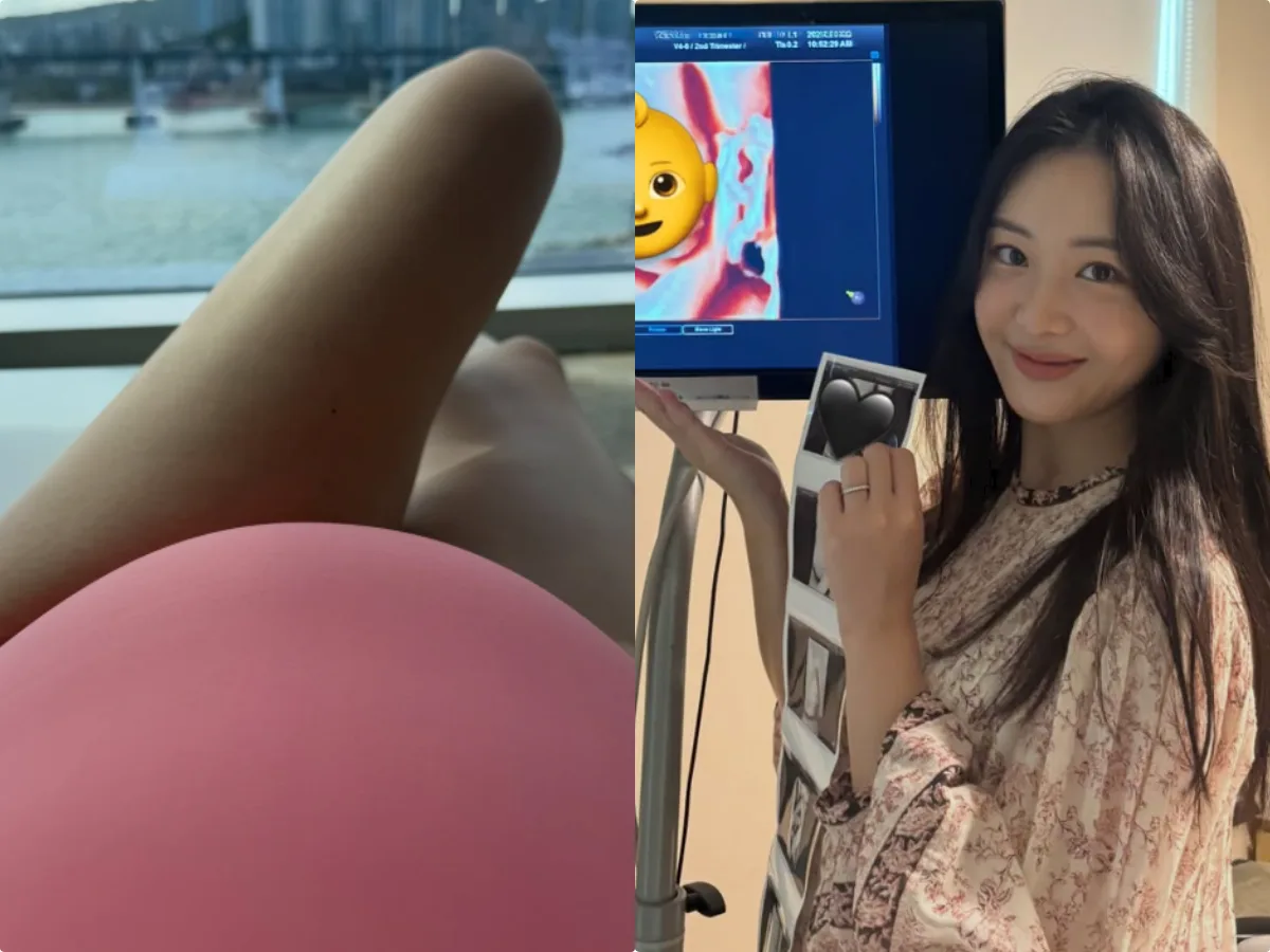 김다영, ♥배성재와 12월 출산 앞두고 D라인 공개…“물풍선 같기도”