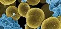 El CSIC desarrolla nuevos materiales antimicrobianos para prevenir infecciones sin favorecer resistencias