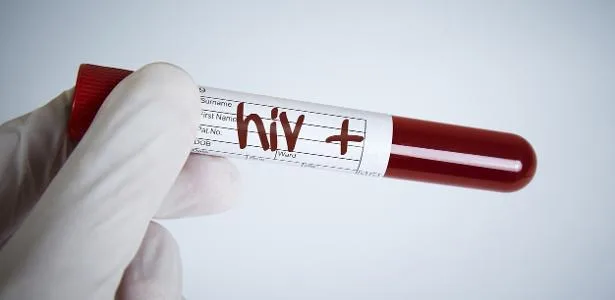 Injeção contra HIV chega à Inglaterra, mas Brasil fica sem acesso