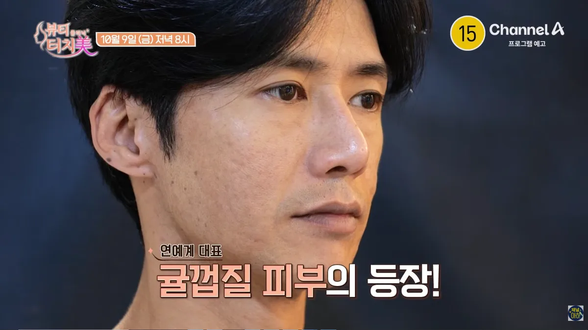 오종혁, ‘귤껍질 피부’ 감추려 두꺼운 화장…오히려 악순환