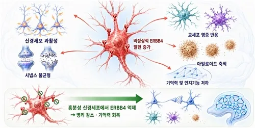 알츠하이머 악순환 키우는 핵심 인자 찾았다…새 치료 표적 기대