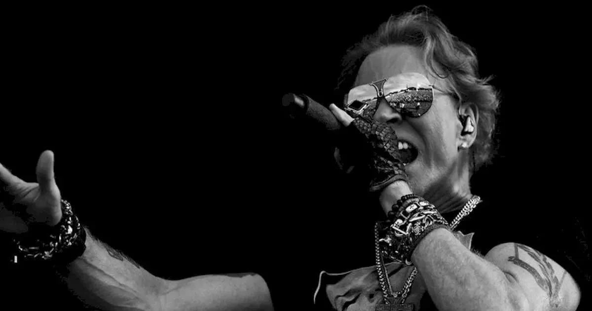 Axl Rose revela diagnóstico de ATM e descreve fortes dores na mandíbula