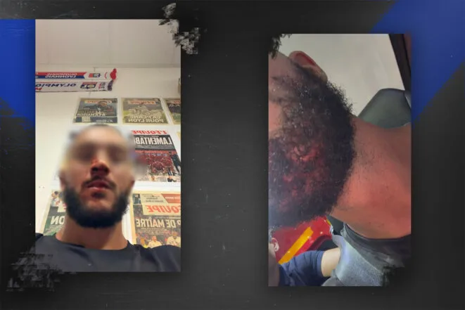 Deux agressions violentes en marge d’un match de l’OL, des hooligans pointés du doigt
