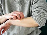 This is the symptom-less condition I keep seeing on blood tests. It contributes to more deaths every year than brain or prostate cancer... yet so many haven't heard of it. This is what you need to know: DR PHILIPPA KAYE