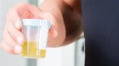 Urine test can spot more than nine in 10 bladder cancers