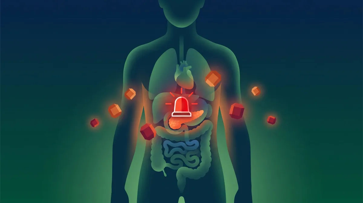 Hiperglucemia: cuándo actuar de inmediato y qué señales obligan a pedir ayuda