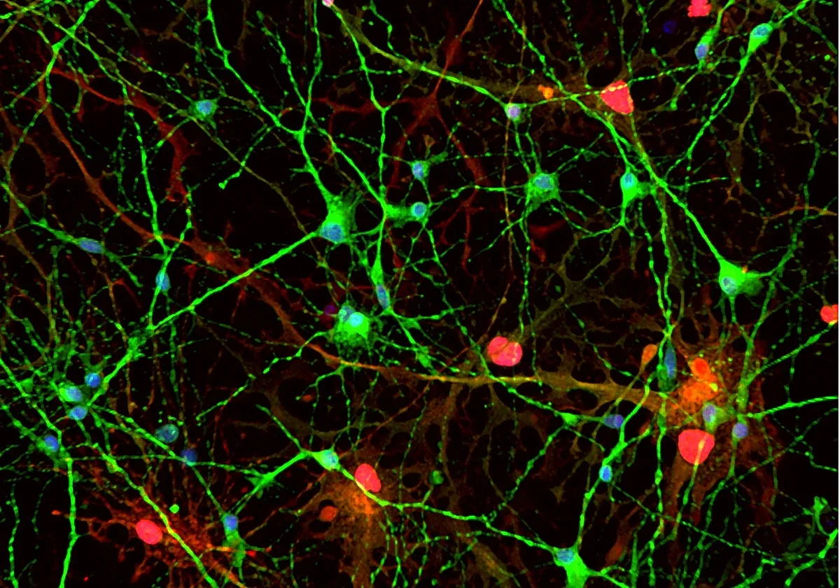 Una investigación descubre un nuevo mecanismo del Alzheimer por una proteína
