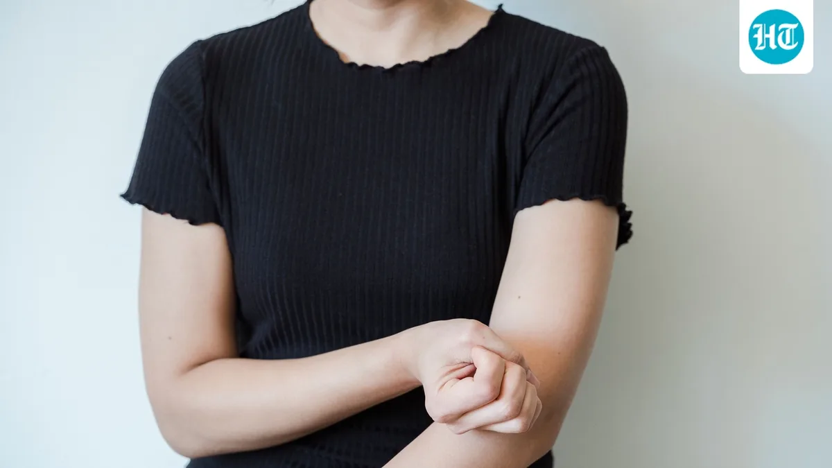 Itching and hives for more than 6 weeks? Dermatologist shares 5 signs that it is not an allergic reaction but a chronic condition
