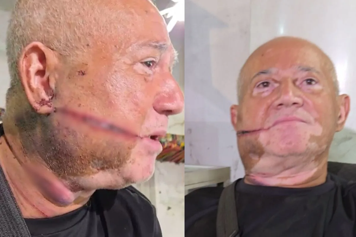 Comerciante acorda com facão no rosto, luta com bandido e tenta salvar a própria vida durante roubo: 'Assustado'