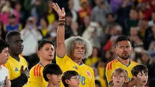 ¿El Pibe Valderrama se rapó o es una treta publicitaria?