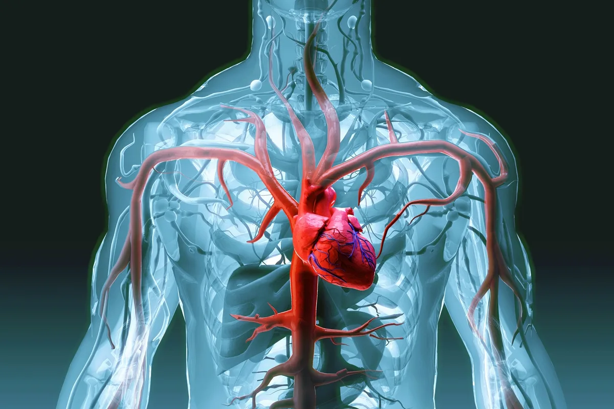 Nova classificação do infarto busca facilitar diagnóstico e tratamento