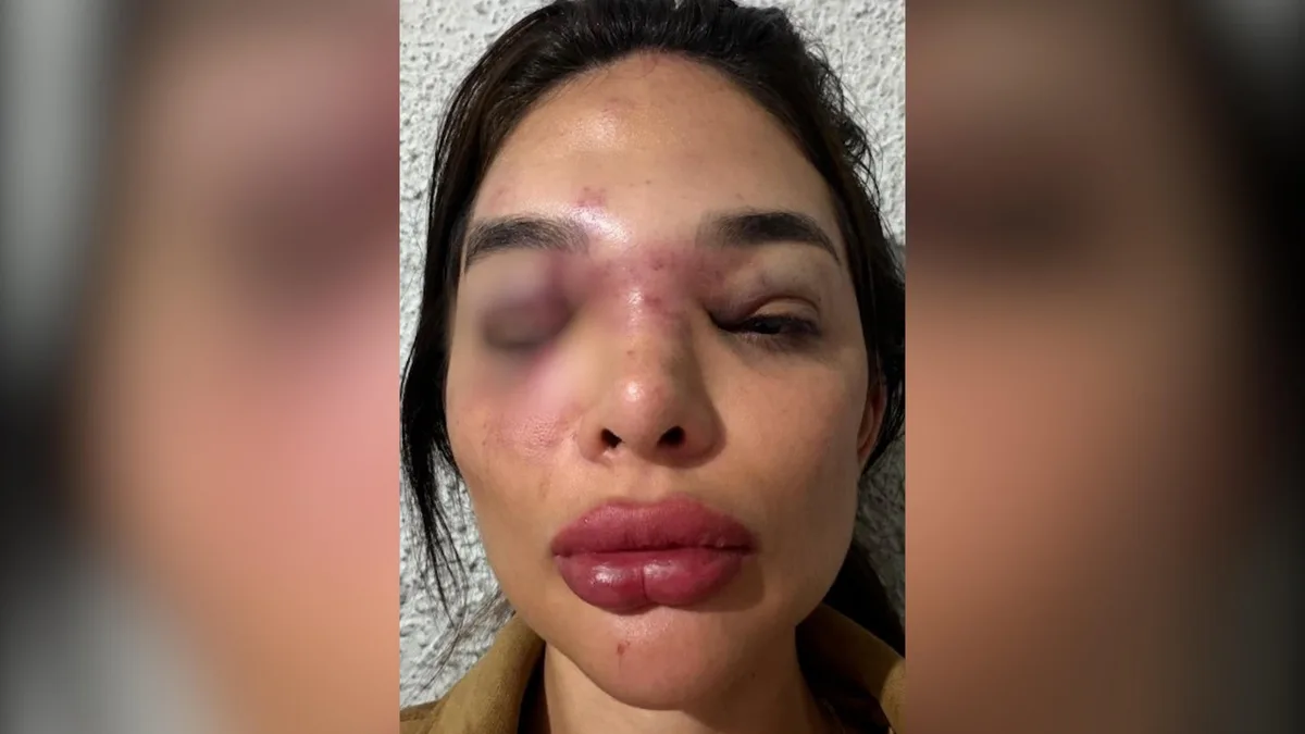 Empresário do mercado financeiro é preso em SP por violência doméstica
