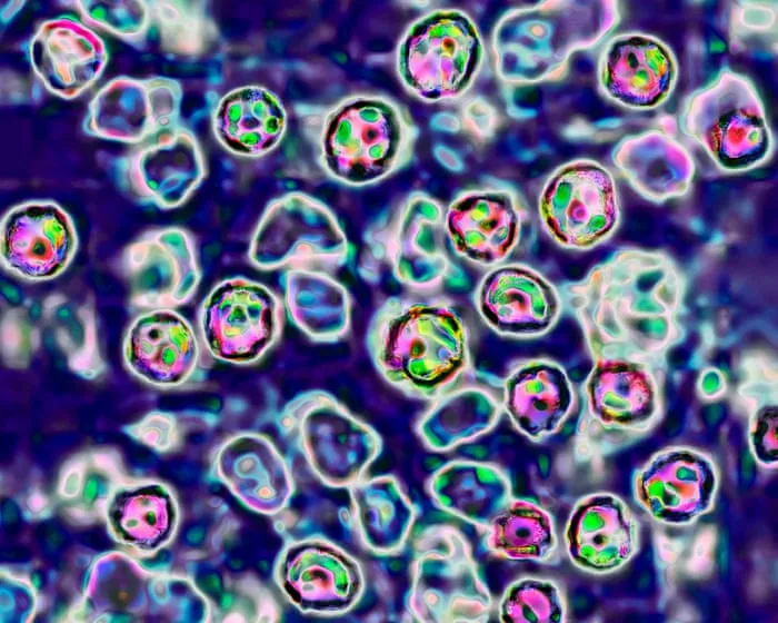 Two unvaccinated people die of measles in Pennsylvania