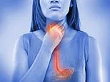 My confession to everyone who takes heartburn drugs for acid reflux... and why I'm telling my patients to ditch them as soon as possible: DR PHILIPPA KAYE reveals ticking timebomb of side effects so many are unaware of
