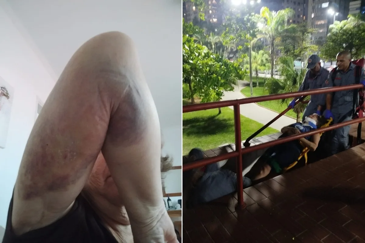 Guarda-corpo cede e mulher cai de escadaria durante exercício na orla de Santos