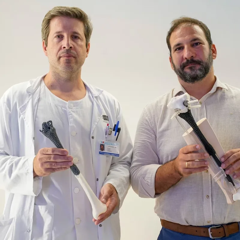 Actualité : “Je vais enfin remarcher” : atteint d'un cancer, un Français a évité l'amputation grâce à un implant imprimé en 3D