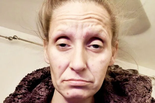 I got addicted to camping gas at 14 and had to pull out all my teeth