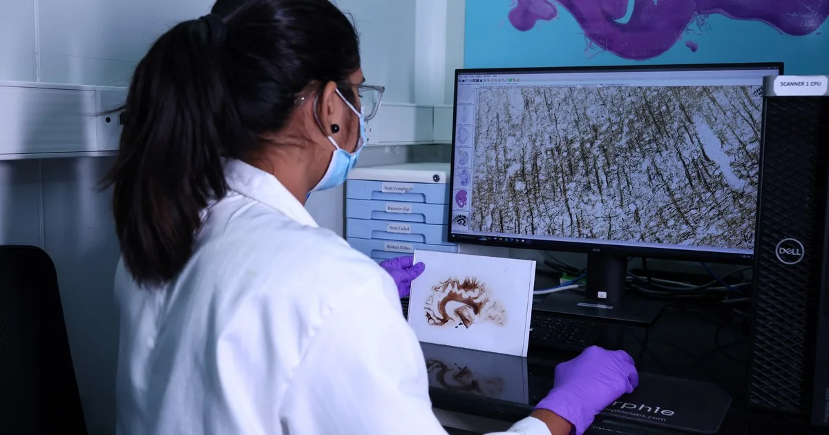 El "Google Maps" del cerebro humano: así se construye el atlas celular que busca descifrar las enfermedades neurodegenerativas