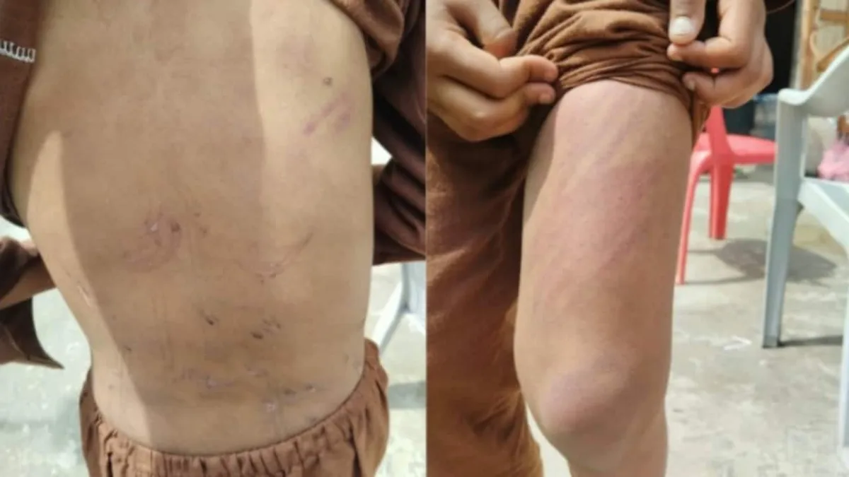 Boy, 9, Thrashed By Teacher At Jammu Madrasa, Rescued 30 Km Away