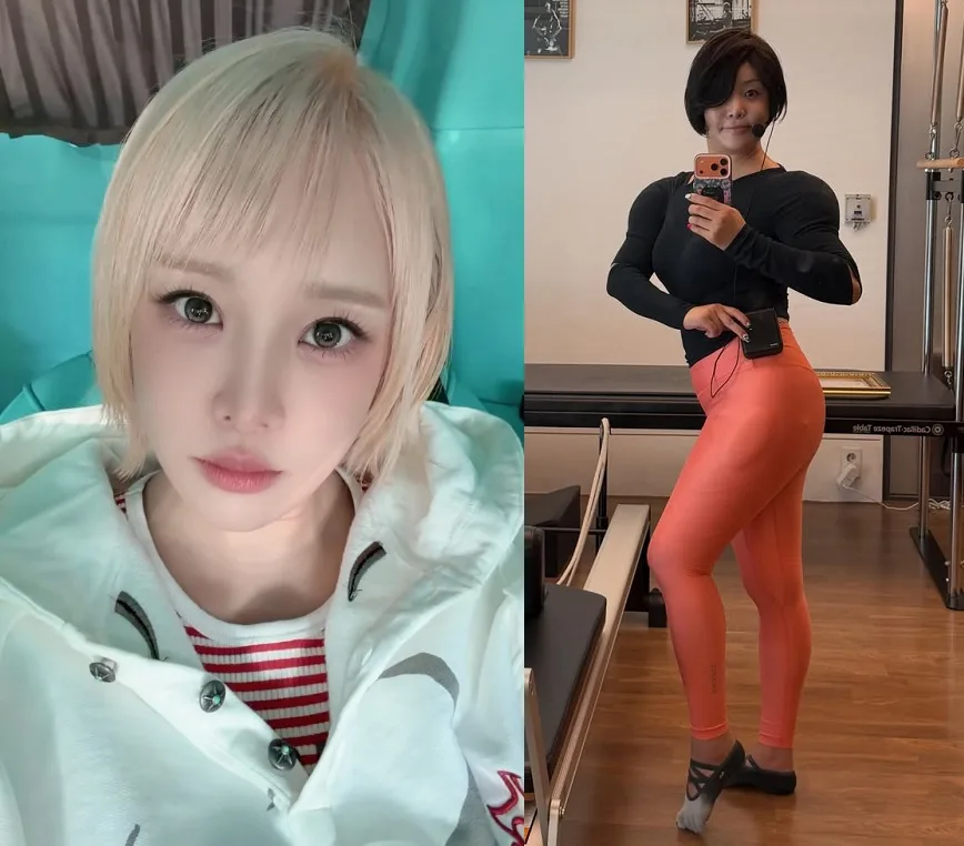랄랄, “10kg 뺐는데 복부지방은 그대로”… 뭐 해야 빠지나?
