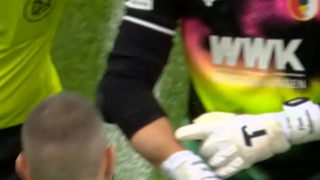 Autsch! - Horror-Beule bei DFB-Star!