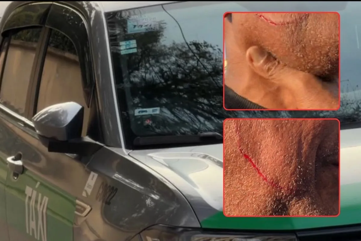 Taxista é ferido com canivete após passageiro anunciar assalto durante corrida em Santos, SP