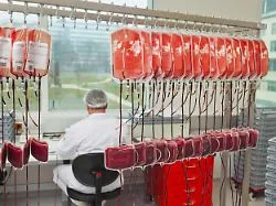 Infektiosität von Amyloid-Beta: Kann eine Bluttransfusion zu Alzheimer führen?
