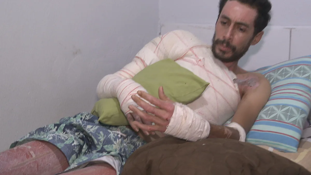 Homem tem mais de 20% do corpo queimado após ser atacado no DF
