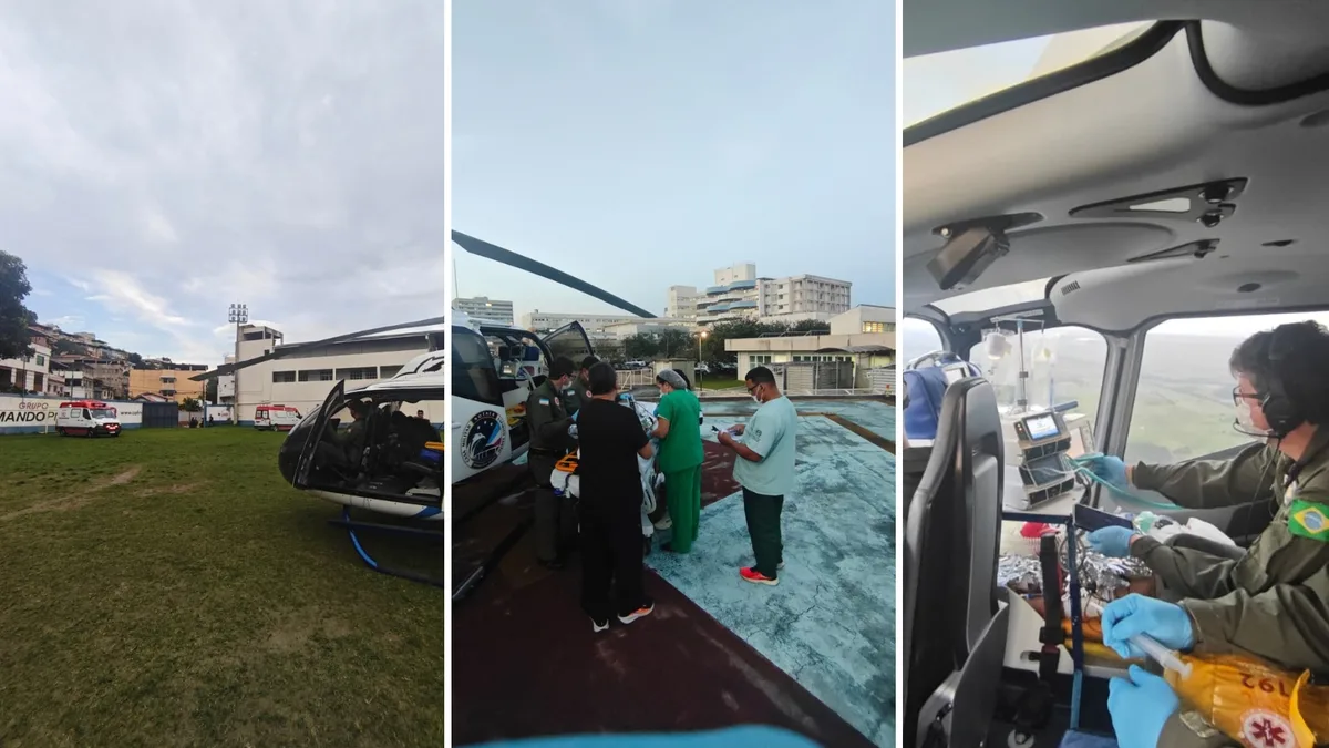 Mulher é intubada após queimaduras comprometerem vias aéreas em Cachoeiro