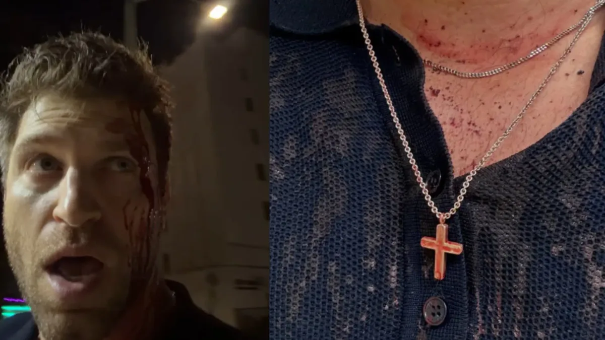 Keegan Allen, de 'Pequeñas Mentirosas', publica un vídeo con la cara ensangrentada: "Querían mi reloj, me habrían matado por él"