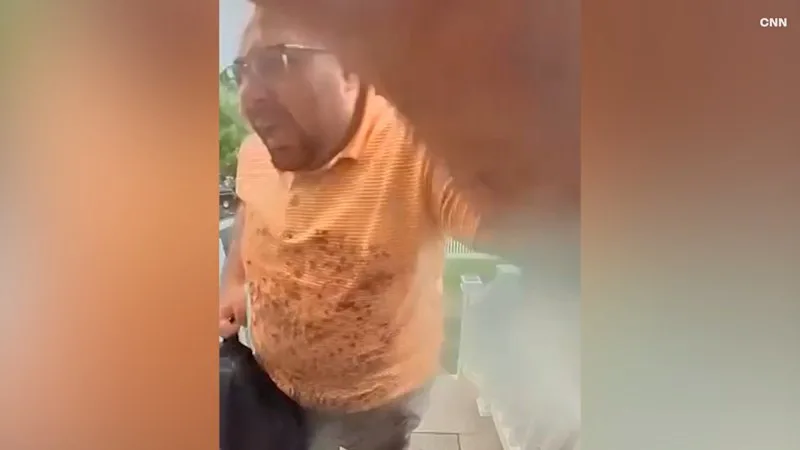 Man survives being struck by lightning outside home