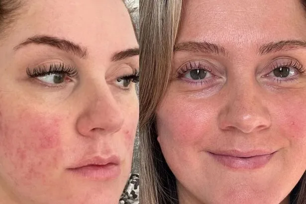 ‘My skin was dehydrated’ but ‘magic potion’ £36 cream ‘made me feel so confident’