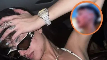 Cómo se llama el corte de cabello de Gala Montes con el que se rapó