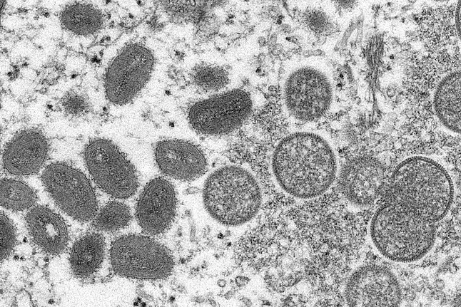Fallece un hombre por mpox en el Hospital Donostia de San Sebastián