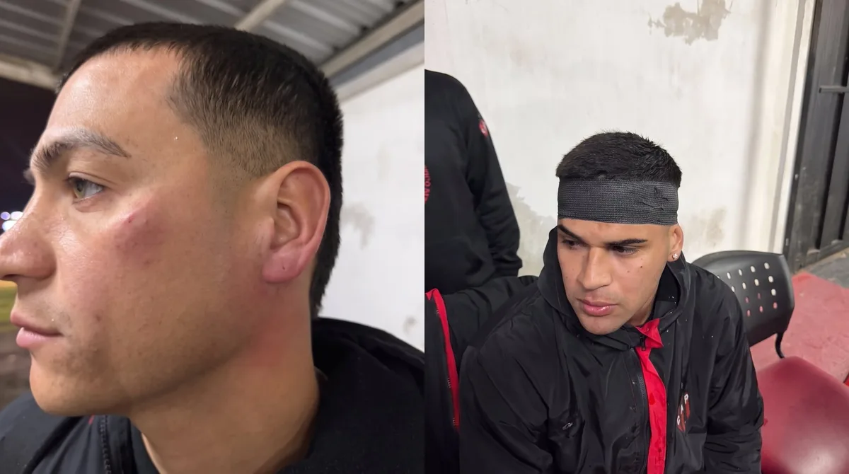 Escándalo por la brutal agresión que sufrieron los jugadores de un plantel del fútbol argentino tras perder un partido