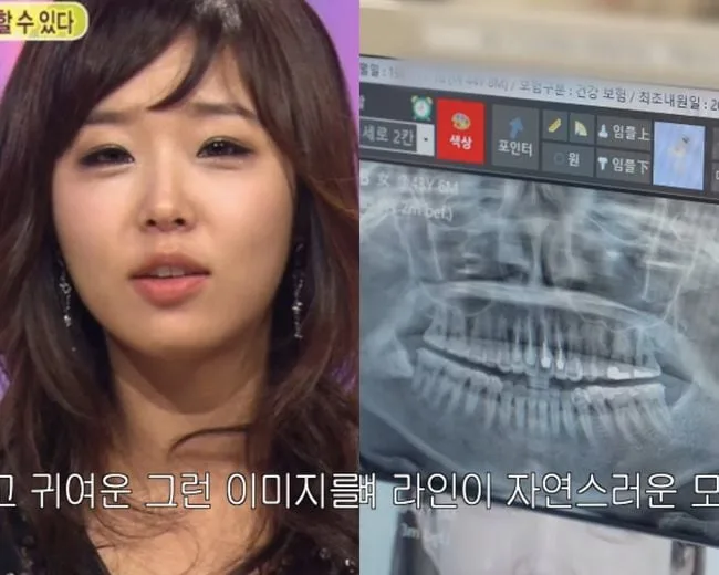 ‘양악수술NO’ 신지, 결국 엑스레이까지 공개..“살 빼고 치과 치료 받아” (어떠신지)