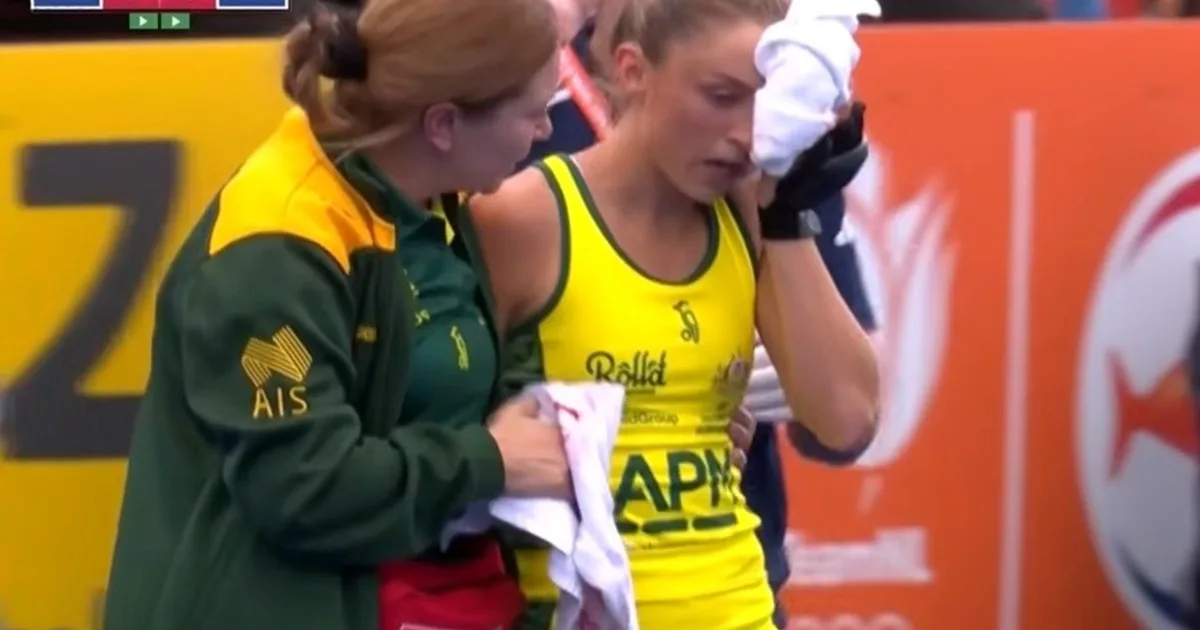 Video: una jugadora sufrió un terrible bochazo en la cara durante el Mundial de Hockey
