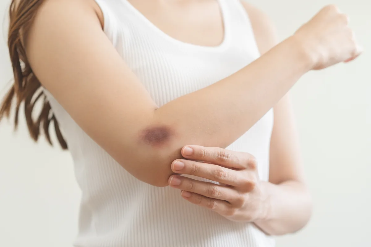 Cansaço, manchas roxas e infecções: quando procurar um médico?