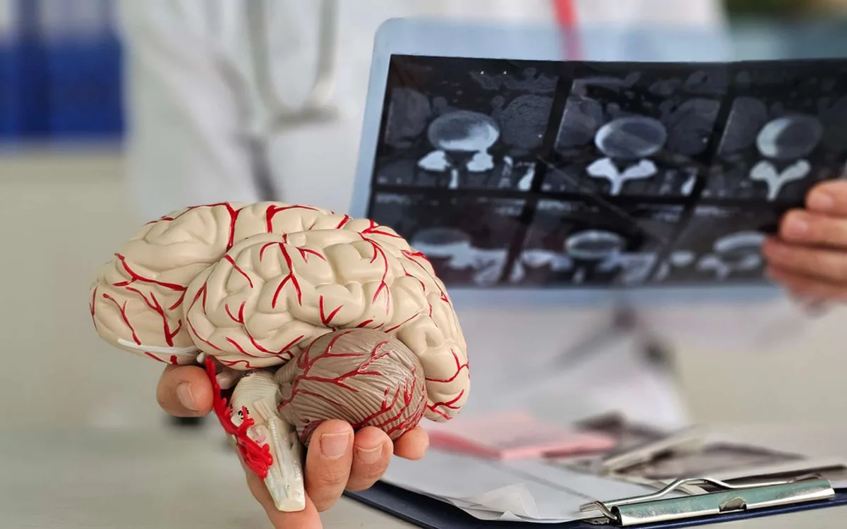 Alzheimer : des scientifiques découvrent un mystérieux « germe » qui pourrait jouer un rôle clé dans la maladie