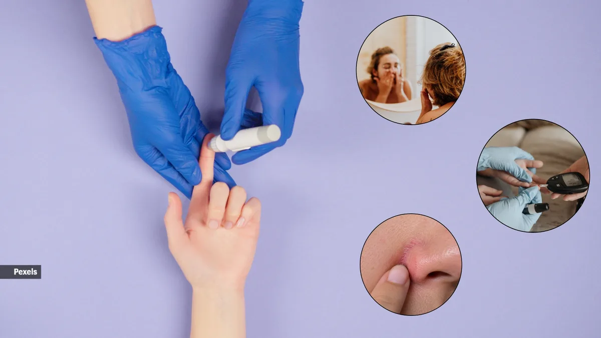 Can you really tell if someone has high blood sugar by looking at their face?