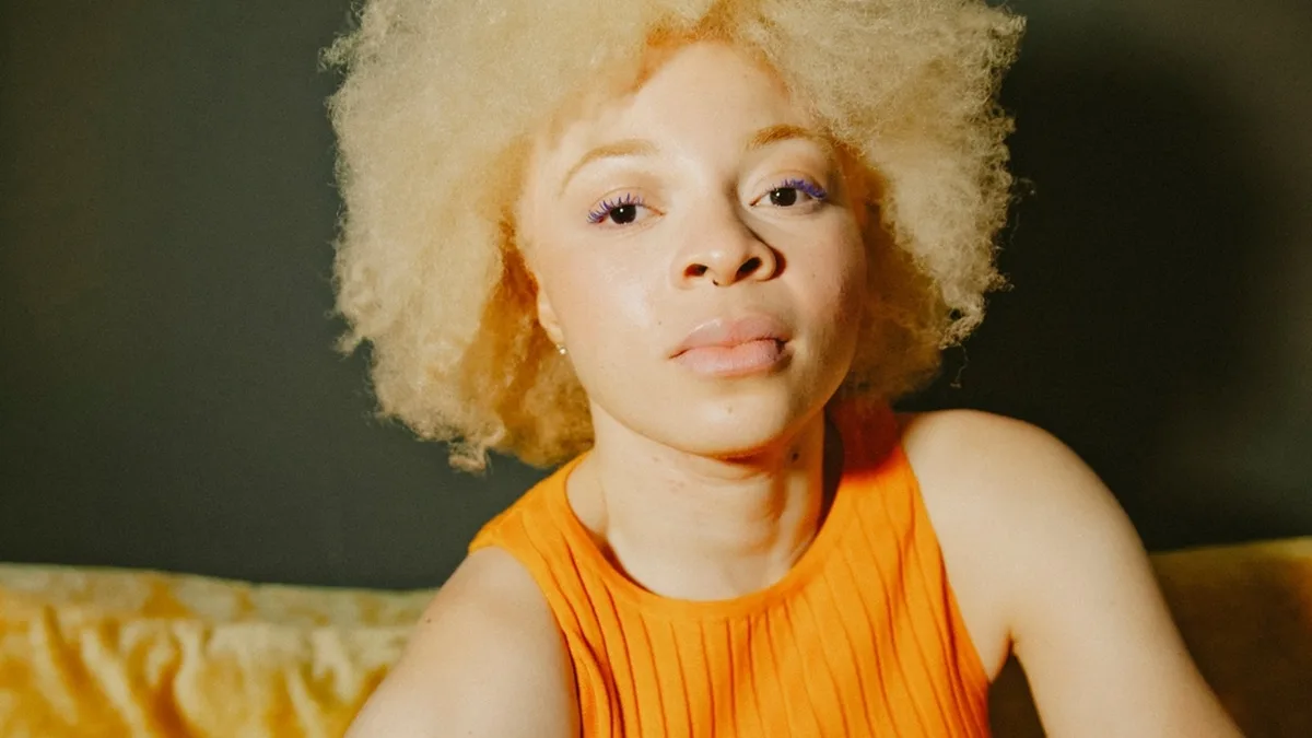 OP-ED | Albinism Awareness Month puts overlooked skin cancer risks in focus
