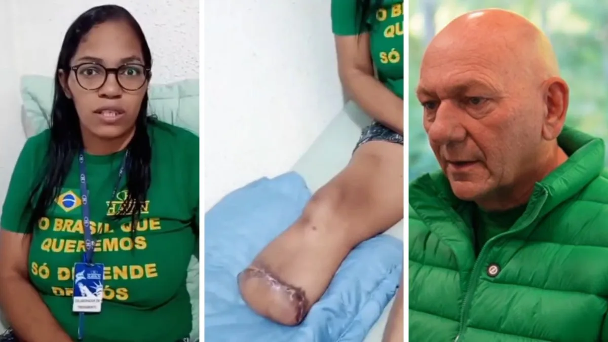 Funcionária pede ajuda para comprar prótese após amputação da perna e Luciano Hang responde a apelo: ‘conte com a família Havan’