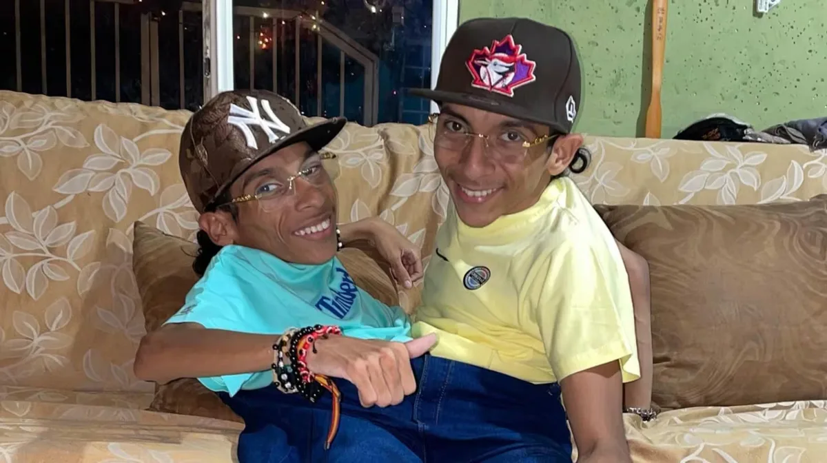 Murieron los hermanos siameses ecuatorianos que viajaron a Colombia para intentar cumplir su sueño
