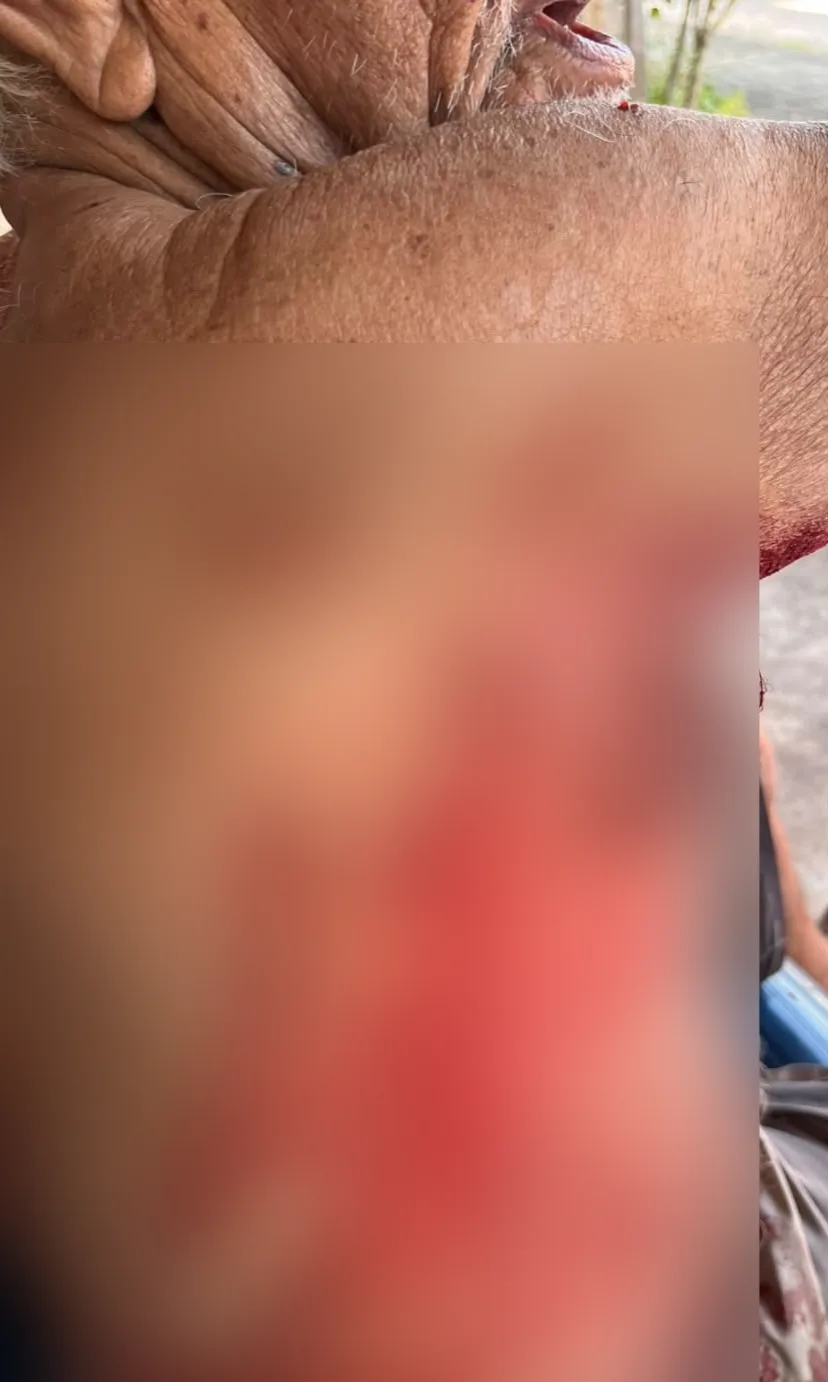 Homem é preso após esfaquear idoso de 84 anos durante tentativa de latrocínio