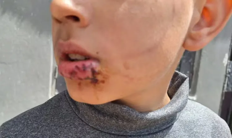 Nuevo ataque de un perro en Córdoba: un nene fue mordido por un pastor alemán mientras jugaba a la pelota